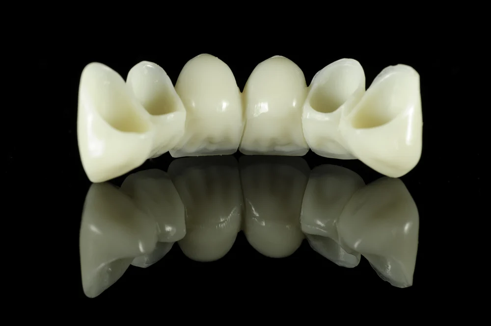 Crowns Kurorat dentare2 Kurorat dentare