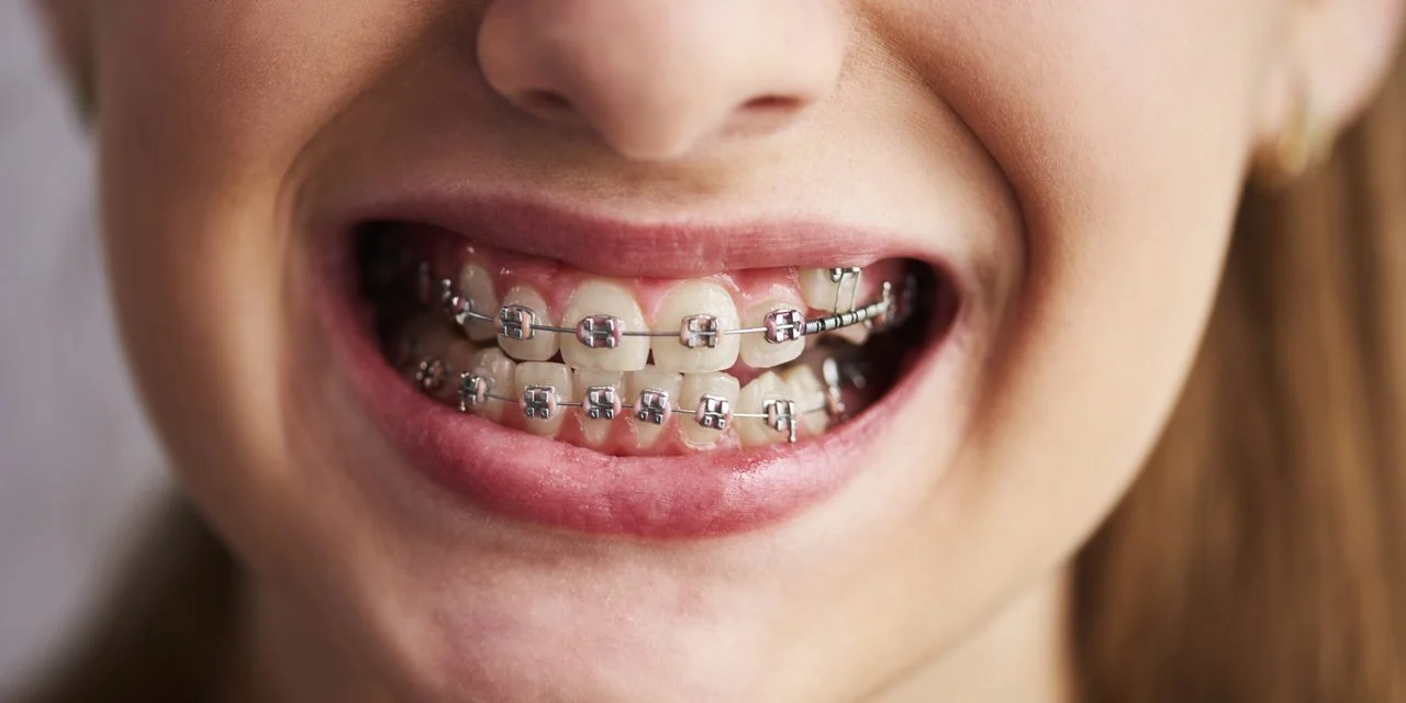 Shërbime Dentistrie Kozmetike 11 Sherbime Dentistrie Kozmetike1 Shërbime Dentistrie Kozmetike