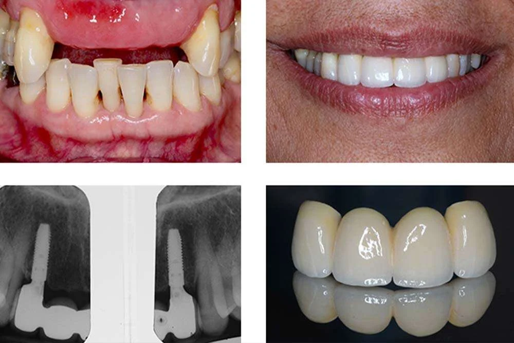 URAT DENTARE 12 URAT DENTARE1 URAT DENTARE