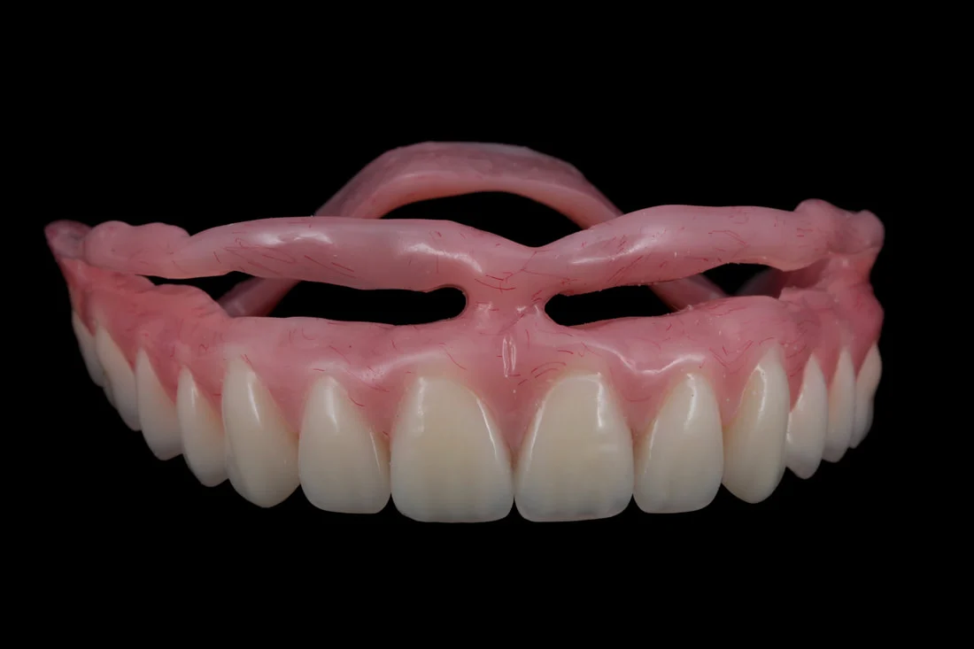 Immediate loading vs delayed loading implants 23 immediate loading vs delayed loading implants3 Immediate loading vs delayed loading implants