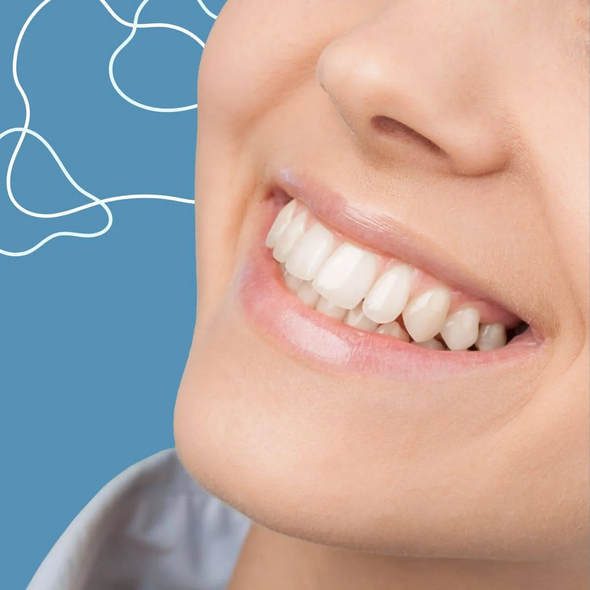 sinus lift4 What Is a Sinus Lift (Cost, Recovery, Risks & Alternatives)