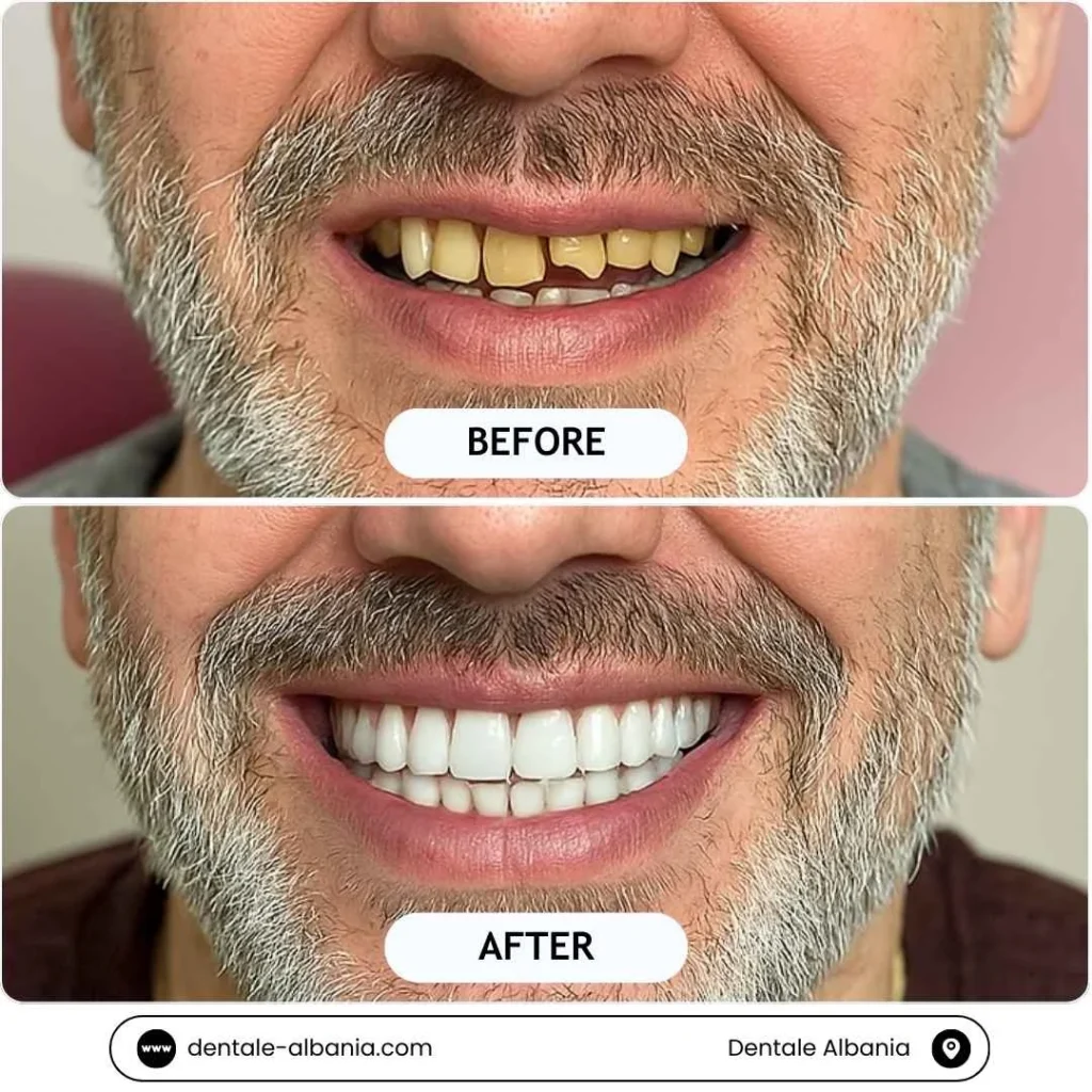 1 1 Albania Tradition