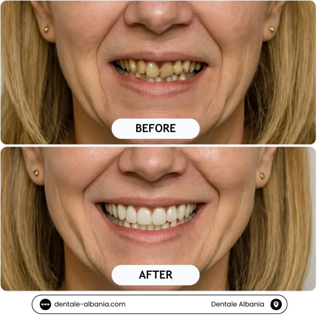 12 1 Albania Tradition