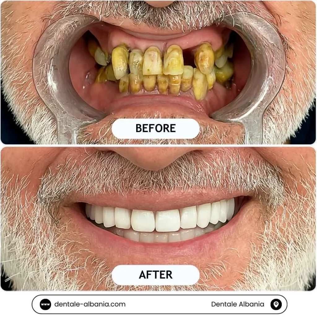 3 1 Albania Tradition