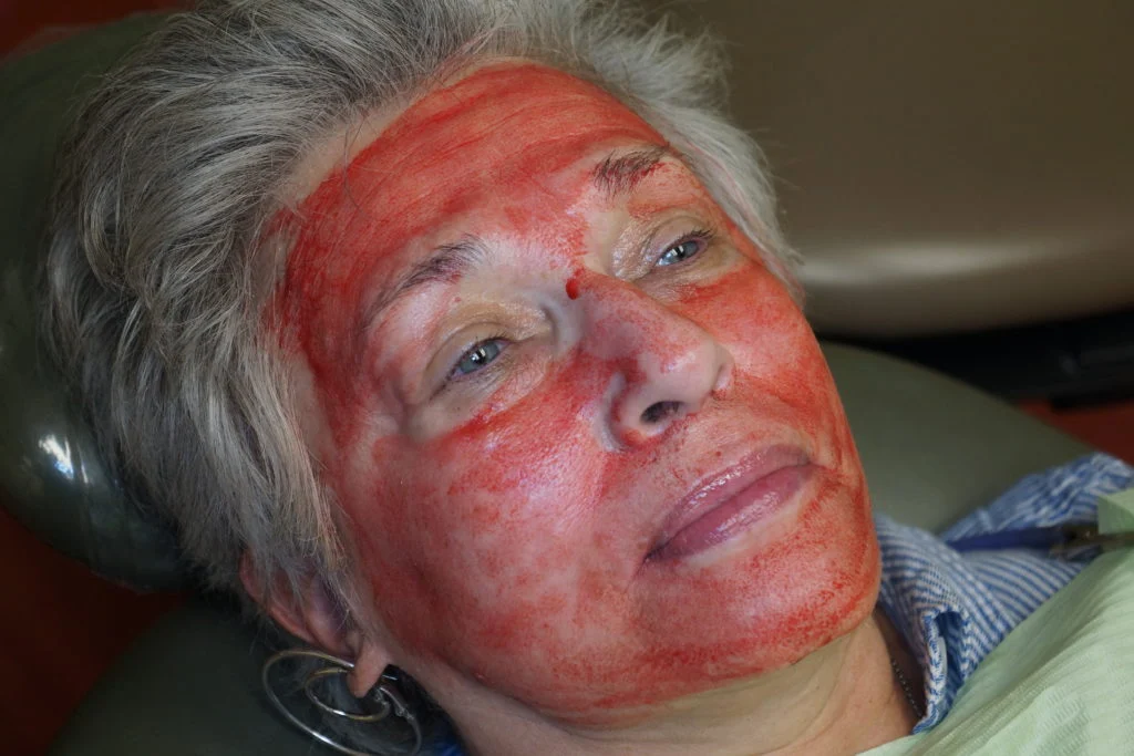 PRF Treatment PRF Treatment (Cost, Benefits & How It Compares to PRP)