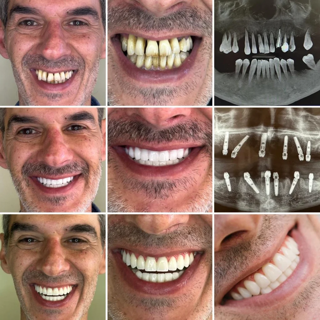 WhatsApp Image 2025 10 30 at 6.03.43 PM Albania Tradition