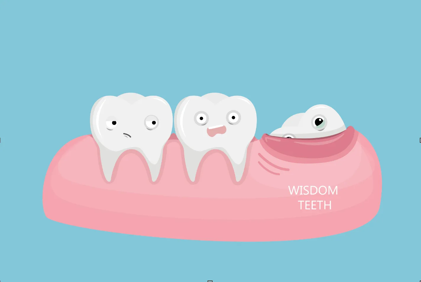 Wisdom Teeth4 Wisdom Teeth (Pain, Symptoms, Removal & When to Keep Them)