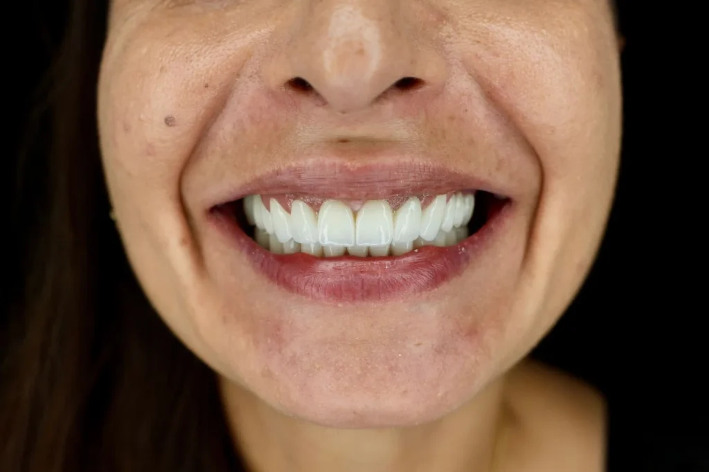 dental tourims Albania Tradition