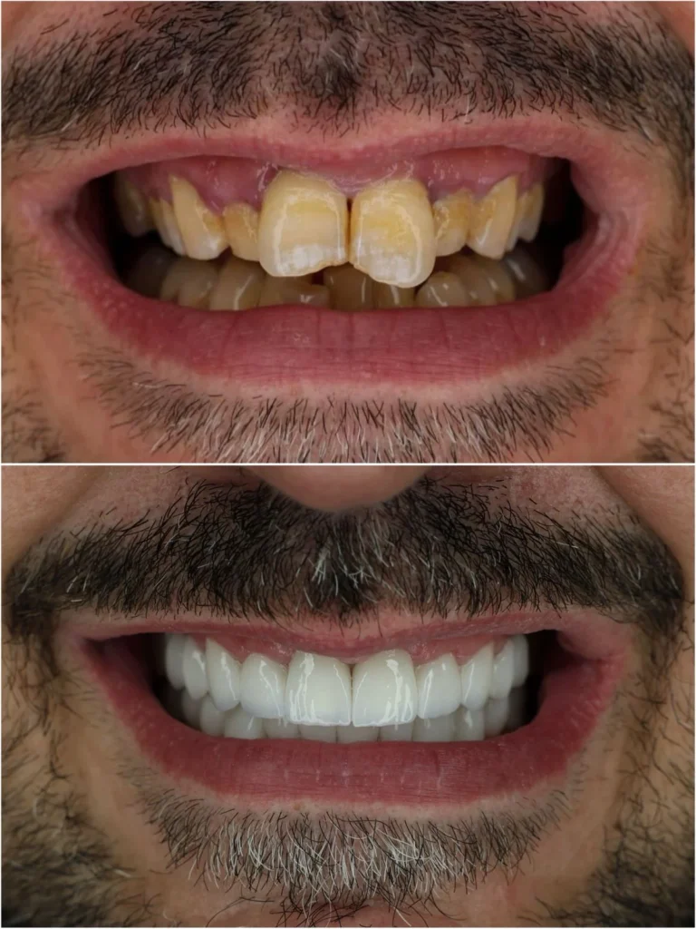 dentale albania Albania Tradition