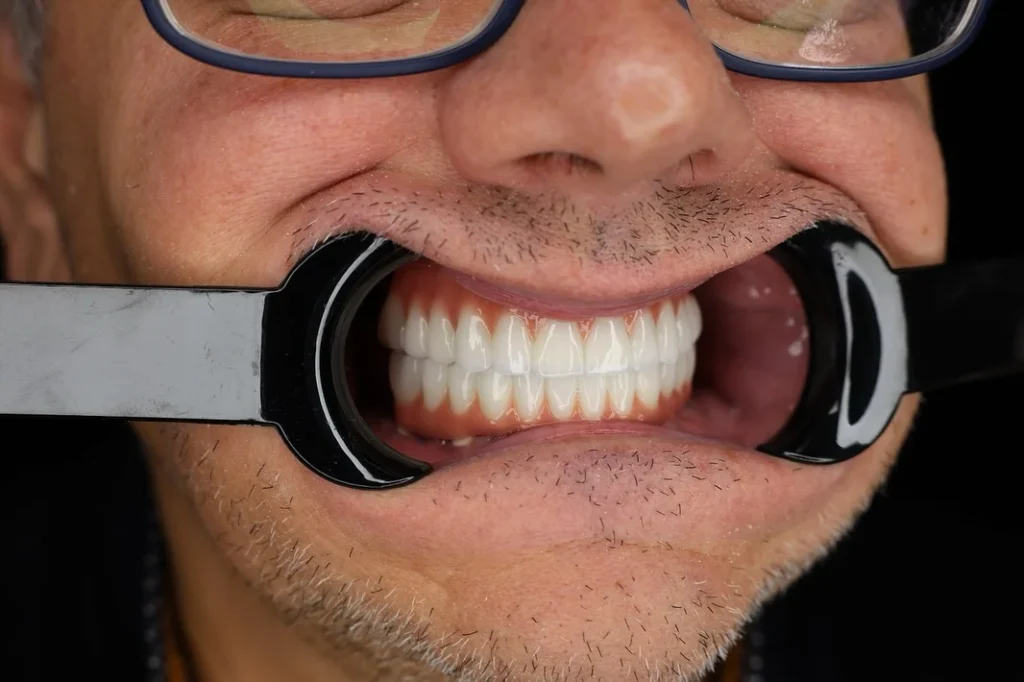 dentale albania1 Albania Tradition