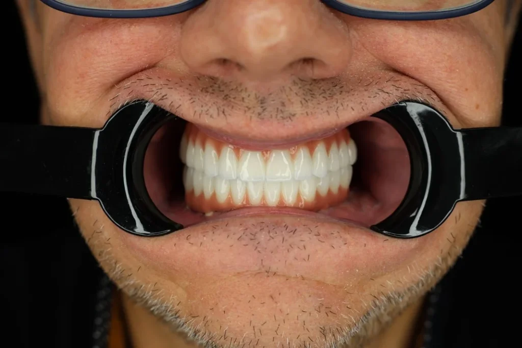 dentale albania2 Albania Tradition