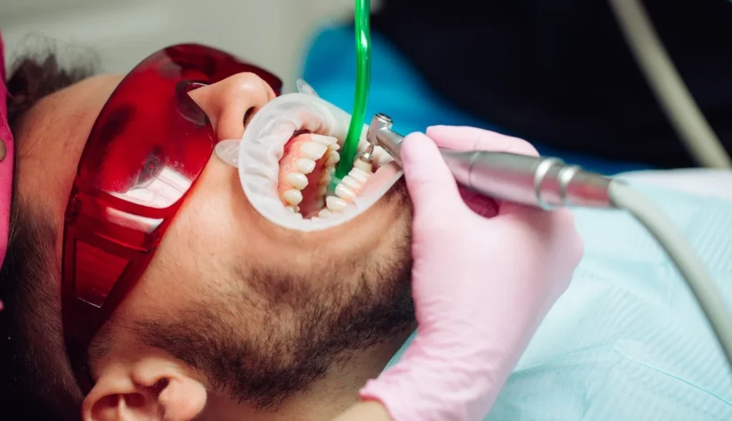 professional dental cleaning4 About us