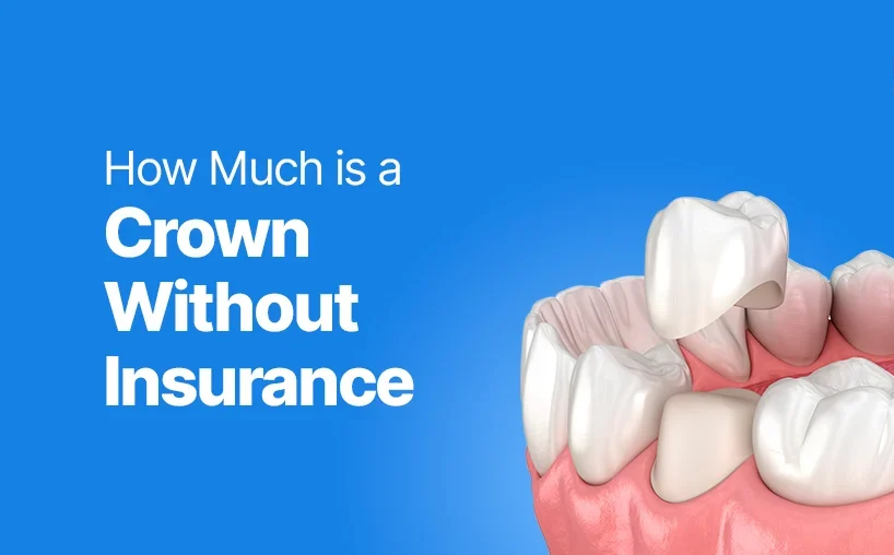 Dental Crown Cost (Factors, Insurance & Affordability) 14 Dental Crown Cost1 e1747231461290 Dental Crown Cost (Factors, Insurance & Affordability)