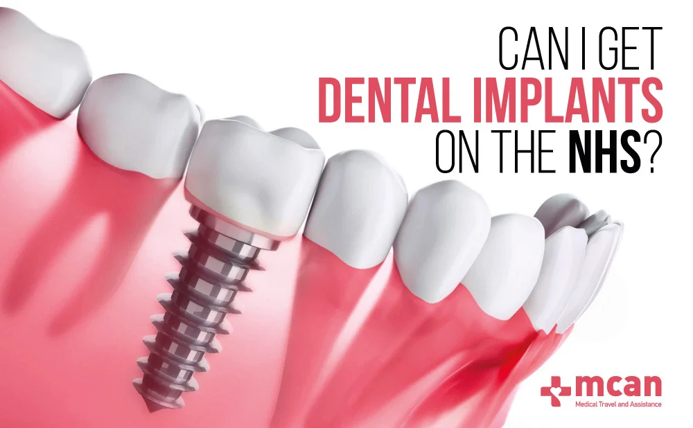 Dental Implants On The NHS