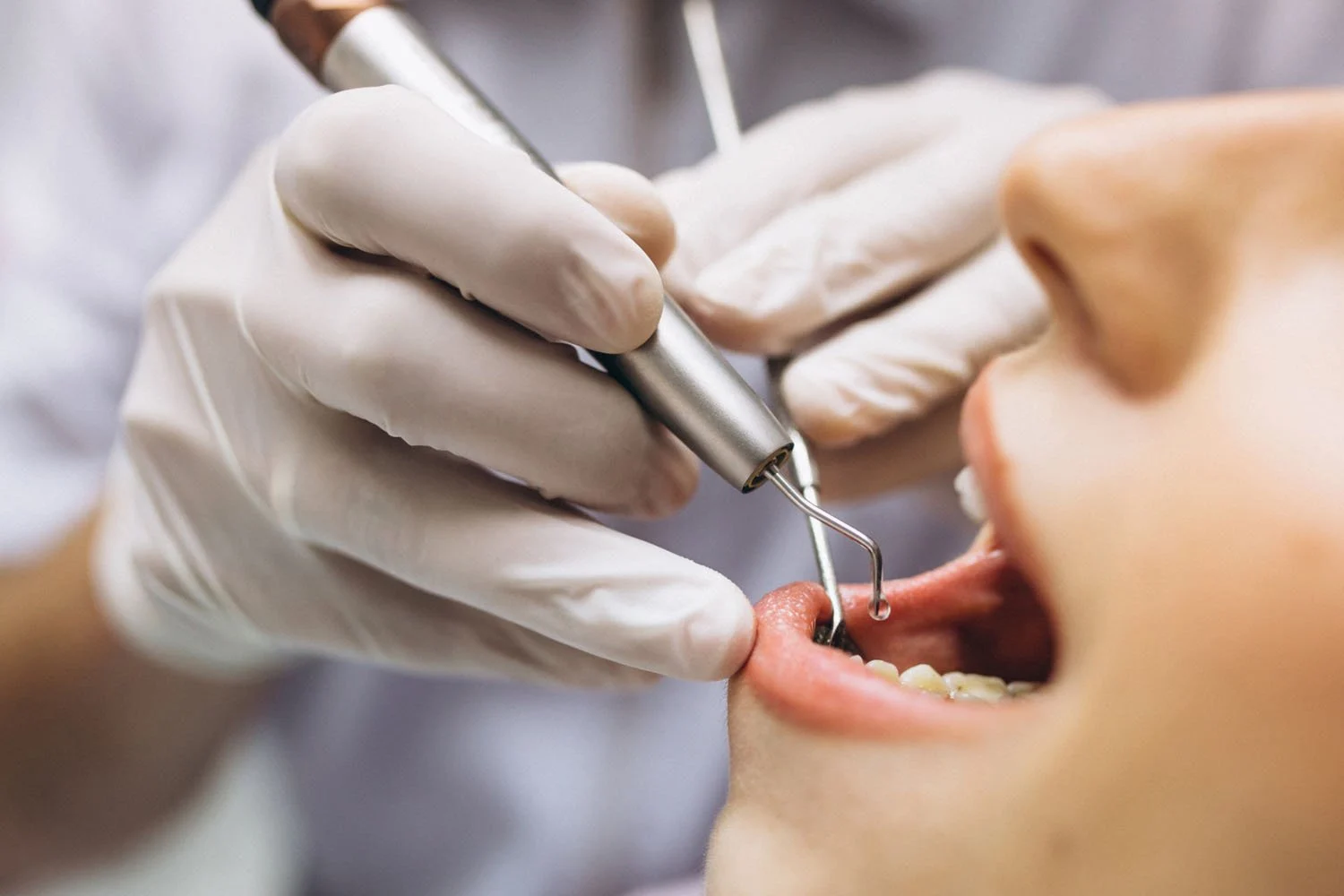 General Dentistry5 General Dentistry (Services, Treatments, Exams & DDS vs DMD)