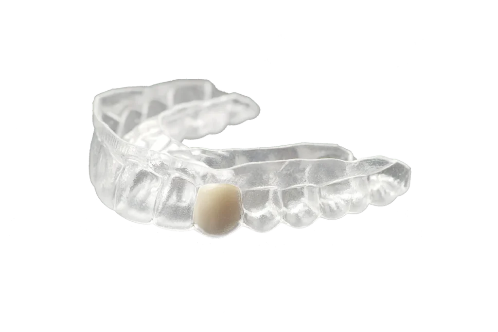 Replacement Retainer (Lost, Broken & Online Options) 6 Replacement Retainer