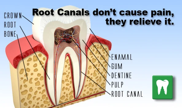 Root Canal And Pain After (Managing Pain & Whats Not Normal) 7 Root Canal And Pain After