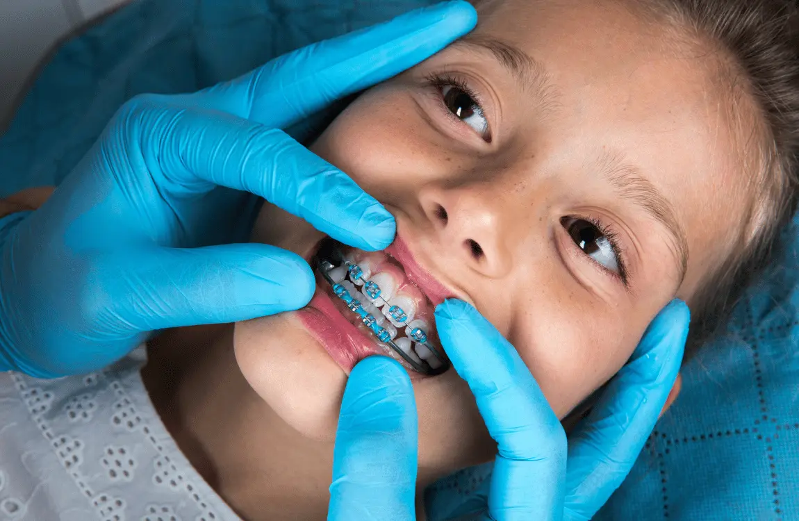 Teeth Filing (Professional Reshaping Vs DIY Risks) 6 Teeth Filing