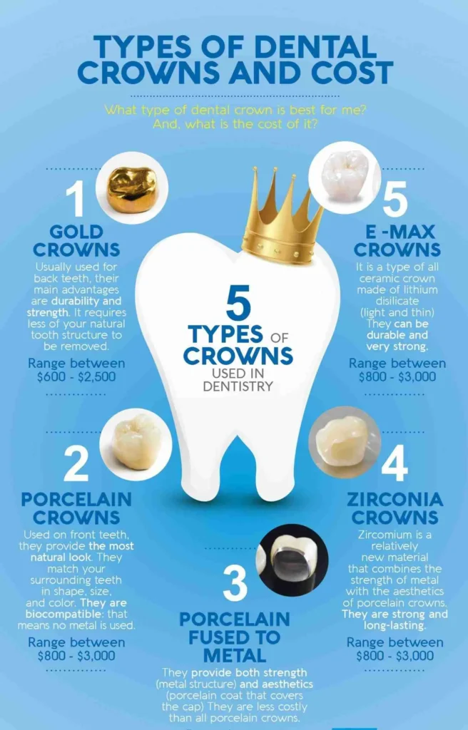 Types Of Crowns