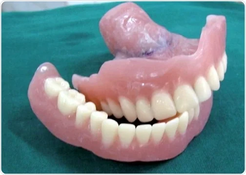 What Are Dentures (Types, UK Costs & Daily Life) 6 What Are Dentures