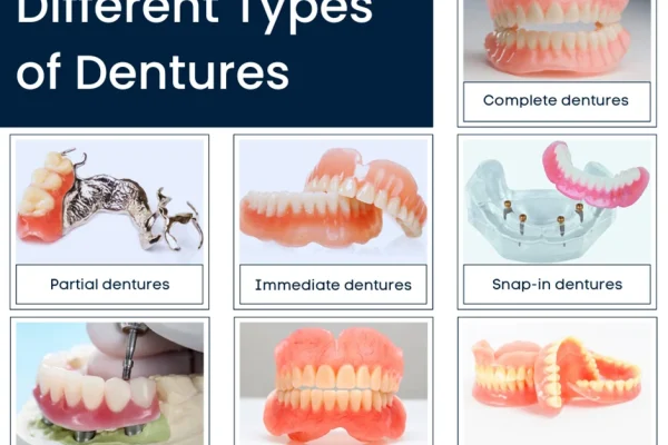 What Are Dentures1